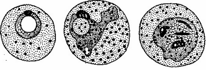 Diagnosticul malariei, tratamentul, prevenirea