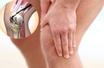 Масаж колінних суглобів при артрозі