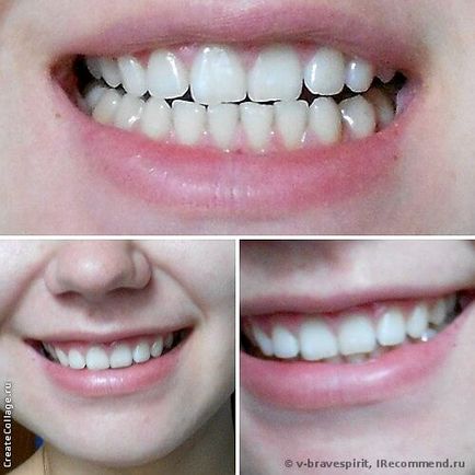 Відбілюючі смужки для зубів crest 3d white whitestrips luxe professional effects - «посміхайтеся,