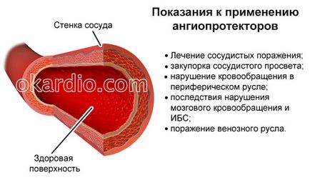 Előkészítés erősítése vérerek vitaminok, kenőcsök, tabletták és injekciók