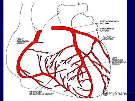 Prezentarea bolii cardiace ischemice