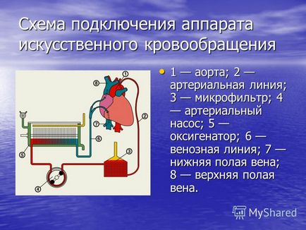 Prezentare pe tema transplantului de inimă în Europa