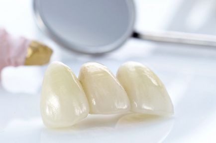 Протезування зубів в СВАО