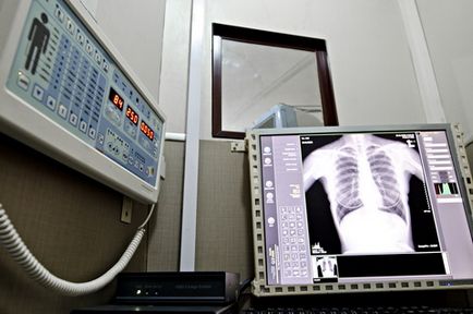 X-ray al plămânilor (organe toracice)
