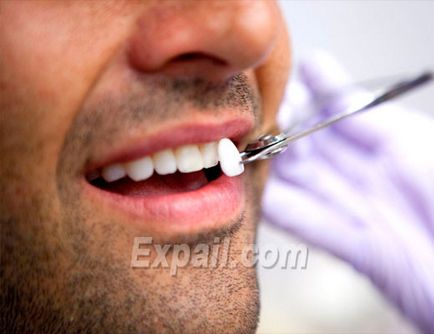 Реставрація зубів в стоматології вартість лікування