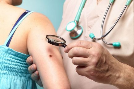 Mole vagy papilloma, és hogyan lehet megkülönböztetni a különbség (papilloma) Mole vagy a bőr tag, és hogyan lehet megkülönböztetni, mi a különbség
