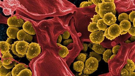 A legérdekesebb tények baktériumok áttekintést, leírást és típusok
