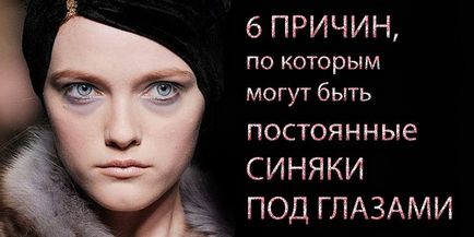 Синці під очима - причини, як позбутися від синців під очима