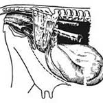 Răsucirea uterului în etiologia animalelor, imaginea clinică, diagnosticul, prognosticul, tratamentul,