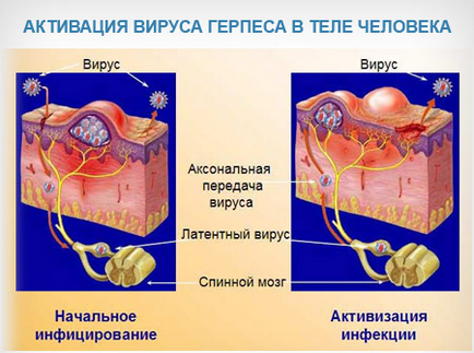 Стоматит мовою, під язиком у дорослих лікування, профілактика