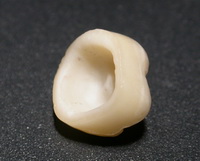 Stomatologie Prizma Nizhnekamsk, dinti artificiale