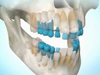 Tehnologia dinților în creștere a fost dezvoltată de oamenii de știință