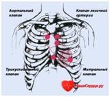 Puncte de auscultare a inimii