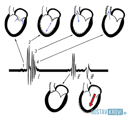 Tonurile cardiace sunt normale, umflate, descriere, auscultare, tipuri de tonuri cardiace