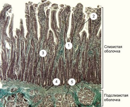 Intestine subțire