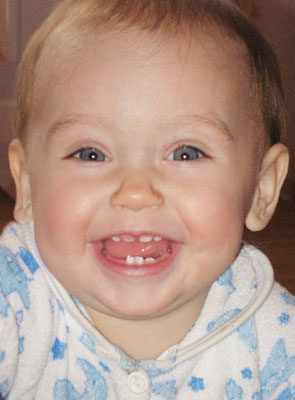 U-інтерв'ю з дитячим стоматологом валентина Вольхін бережіть зуби дитини з моменту її зачаття
