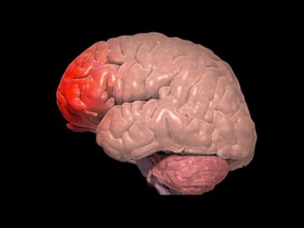 Забій головного мозку наслідки, які можуть з'явитися в майбутньому