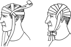 Contuzia simptomelor cerebrale, tratamentul și primul ajutor