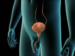 Urethroprostatita cronică, simptomele, medicamentele și medicamentele recomandate