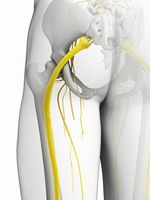 Strângerea nervului sciatic ca factor de stres