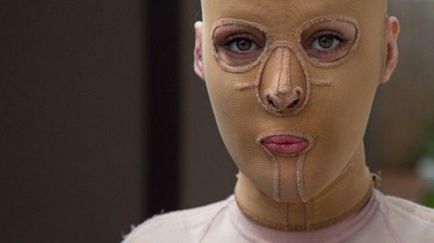 Життя без особи закінчена австралійка зняла маску, яку носила 2, 5 року