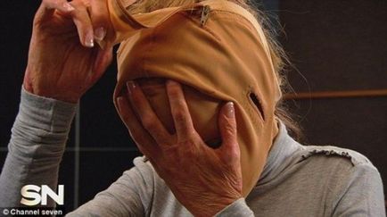 Життя без особи закінчена австралійка зняла маску, яку носила 2, 5 року