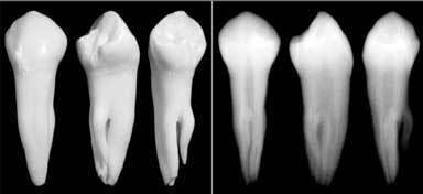 10 Factori pentru succesul tratamentului endodontic