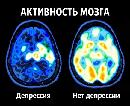 8 Рад нейробіолога про те, як стати щасливим раз і назавжди