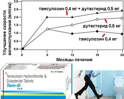 Tratamentul de prostată la adenom - opriți îmbătrânirea