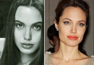 Angelina Jolie înainte și după operația plastică - fotografii și versiuni ale experților