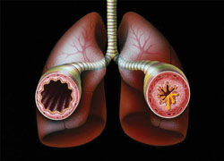 Tratamentul de bază al astmului bronșic