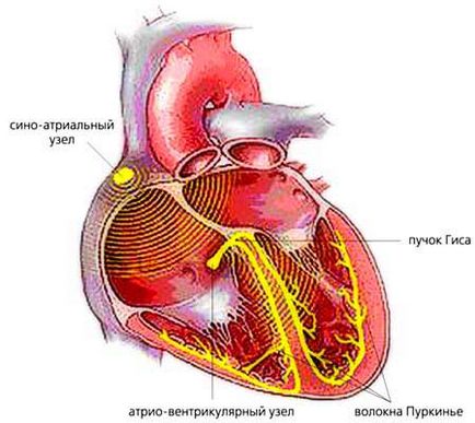 Blocada inimii la copii - simptome ale bolii, prevenirea și tratamentul blocului cardiac la copii, cauze