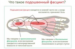 Болить зовнішня сторона стопи причини і лікування