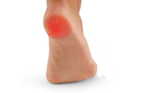 Болі в ступнях і стопах з зовнішньої сторони чому болить зовнішня частина ніг в області стоп збоку