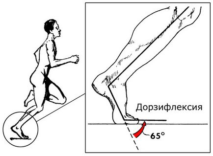 Durerea în călcâie la diagnosticarea, tratamentul, prevenirea sportivilor