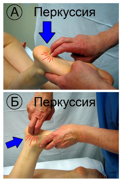 Durerea în călcâie la diagnosticarea, tratamentul, prevenirea sportivilor