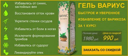 Що робити якщо набрякають ноги при варикозі кращі методи лікування набряків