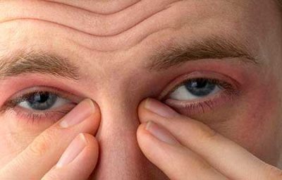 Очна мазь від алергії основні види для лікування свербежу на століттях у дорослих і навколо очей, чи може