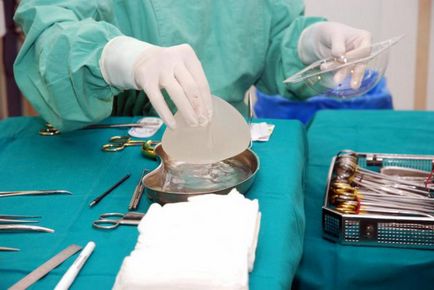 Implanturile mamare ale unei bombe cu ceas