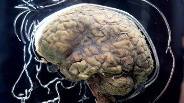 Sporiformă encefalopatie la om și bovine - principalele caracteristici ale bolii