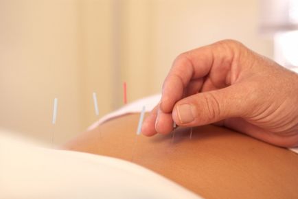 Acupunctura pentru copiii cu dsp - fotografii și recenzii despre tratamentul copiilor pe site-ul clinicii 