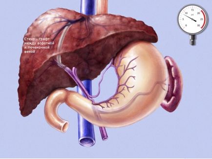 Centrul vascular inovator