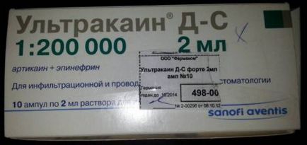 Якими препаратами знеболюють в стоматології Хейхе