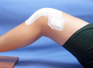 Medicul care tratează artroza articulației genunchiului, metodele și prevenirea