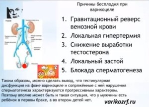 Як запобігти наслідкам варикоцеле і чоловічого безпліддя