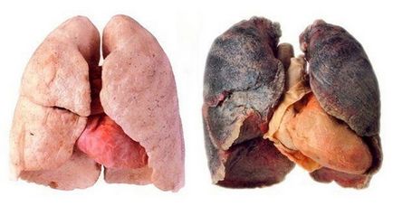 Cum să eliminați toxinele din organism după ce ați fumat produse care elimină toxinele din plămâni