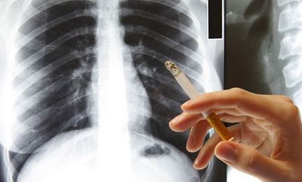 Cum să eliminați toxinele din organism după ce ați fumat produse care elimină toxinele din plămâni