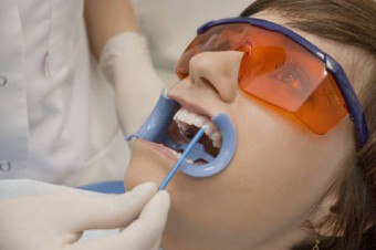 Cum se restabilește smalțul dinților metode de efectuare a procedurii la domiciliu