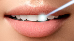 Клініка лазерної стоматології в москві - доступні ціни, висока якість!