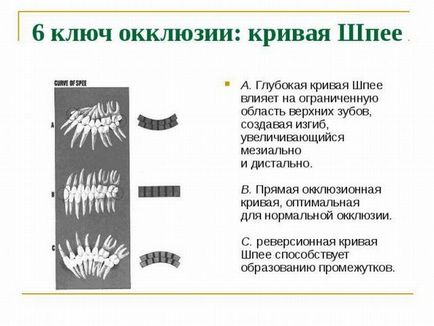 Крива Шпеє в ортодонтії сагиттальная і трансверзального окклюзионная дуга